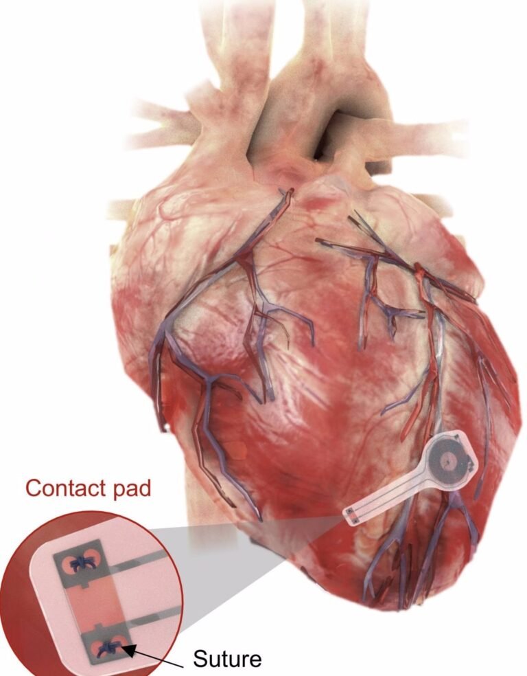 cientificos-desarrollan-un-marcapasos-que-se-disuelve-en-el-cuerpo