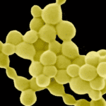 cientificos-descubren-una-bacteria-que-produce-oro