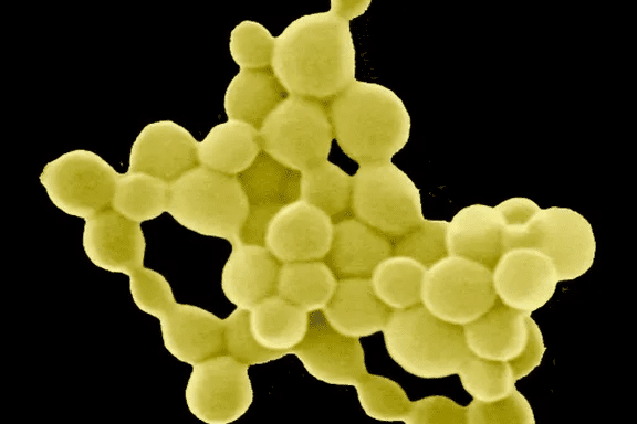 cientificos-descubren-una-bacteria-que-produce-oro