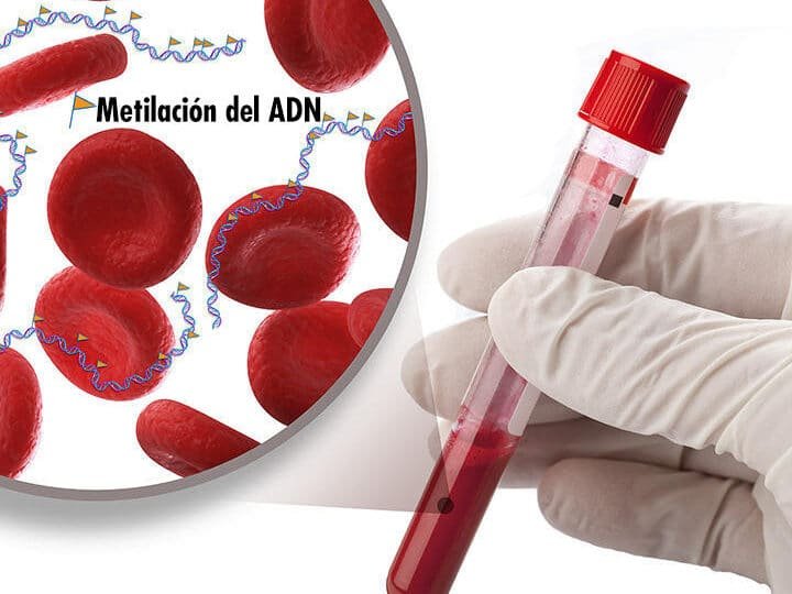la-tecnologia-de-biopsia-liquida-para-detectar-cancer-en-sangre