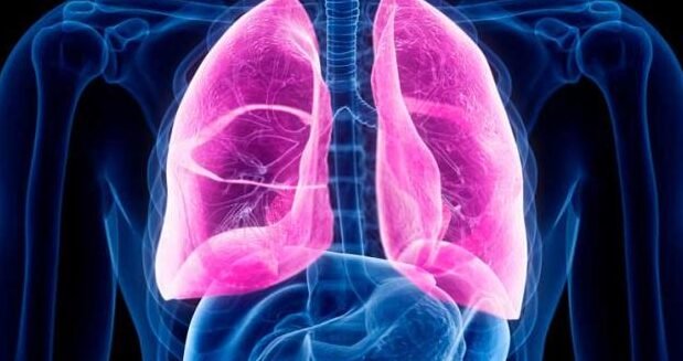 un-nuevo-enfoque-para-tratar-la-fibrosis-quistica